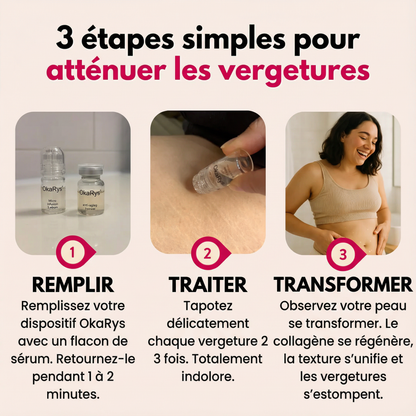 Le Rituel de micro-infusion Vergetures