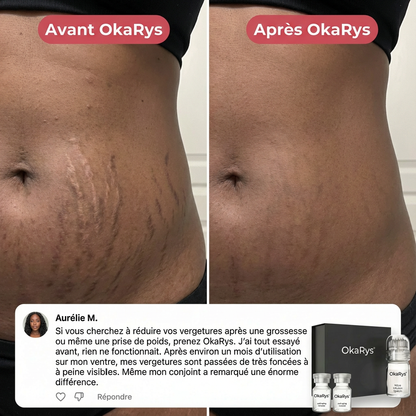 Le Rituel de micro-infusion Vergetures