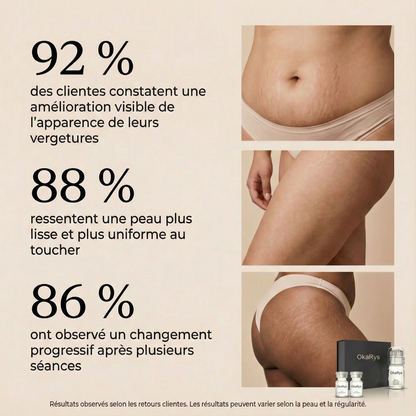 Le Rituel de micro-infusion Vergetures